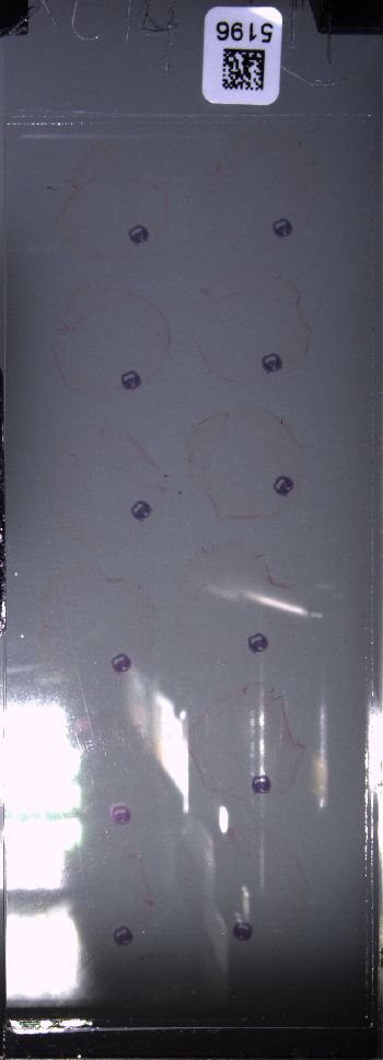 Media type: image; Special Collections 4011   shows specimen_part histological serial section;